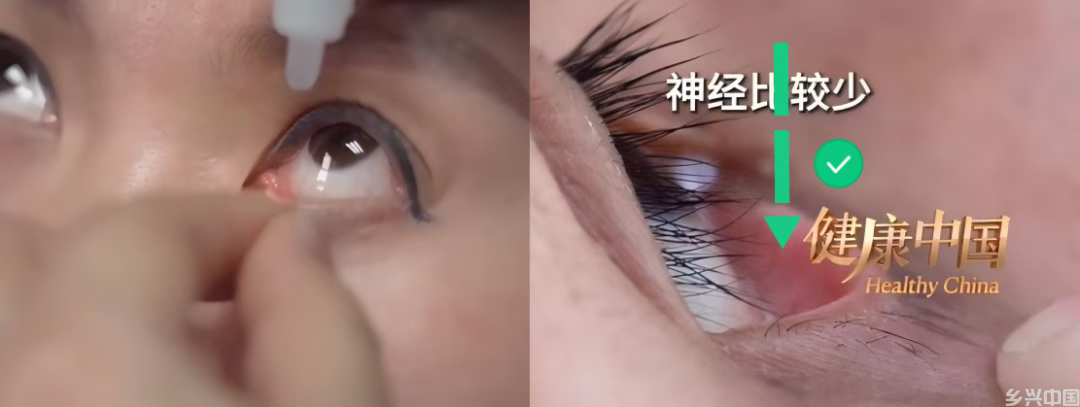 干眼急救！这个错误动作悄悄伤眼，九成人事后才发现(图3)